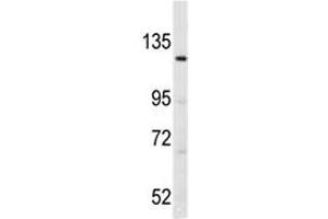 Western Blotting (WB) image for anti-LATS, Large Tumor Suppressor, Homolog 1 (Drosophila) (LATS1) (AA 1-30) antibody (ABIN3031593)