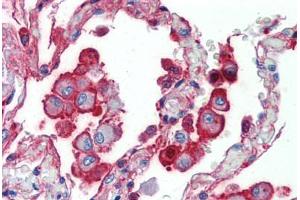 Human Lung (formalin-fixed, paraffin-embedded) stained with ALPL antibody ABIN462352 followed by biotinylated anti-mouse IgG secondary antibody ABIN481714, alkaline phosphatase-streptavidin and chromogen. (ALPL 抗体)