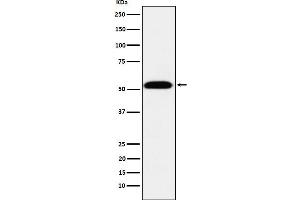 Western blot analysis of TEAD1 expression in 293T cell lysate. (Recombinant TEAD1 抗体)