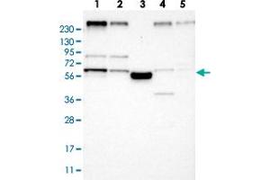 Western blot analysis of Lane 1: RT-4, Lane 2: U-251 MG, Lane 3: Human Plasma, Lane 4: Liver, Lane 5: Tonsil with FAM134C polyclonal antibody  at 1:250-1:500 dilution. (FAM134C 抗体)