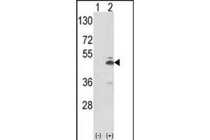 Western blot analysis of PKM2 (arrow) using rabbit polyclonal PKM2 Antibody (N-term ) (ABIN653018 and ABIN2842641). (PKM2 抗体  (N-Term))
