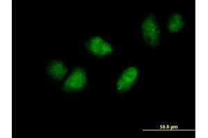 Immunofluorescence of purified MaxPab antibody to DDX3Y on HeLa cell. (DDX3Y 抗体  (AA 1-660))