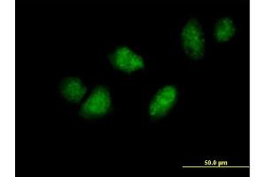 Immunofluorescence of purified MaxPab antibody to DDX3Y on HeLa cell. (DDX3Y 抗体  (AA 1-660))