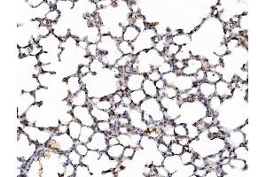 IHC analysis of Galectin 3/LGALS3 using anti-Galectin 3/LGALS3 antibody (ABIN3043400). (Galectin 3 抗体  (AA 153-264))