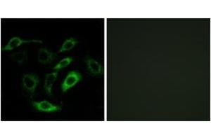 Immunofluorescence analysis of A549 cells, using PTGDR Antibody. (PTGDR 抗体  (AA 263-312))