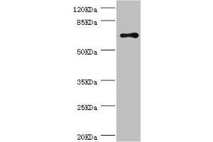 Western blot All lanes: RNGTT antibody at 1. (RNGTT 抗体  (AA 1-260))