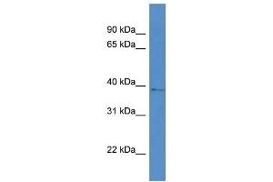Western Blot showing AKR1D1 antibody used at a concentration of 1 ug/ml against RPMI-8226 Cell Lysate (AKR1D1 抗体  (Middle Region))