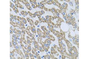 Immunohistochemistry of paraffin-embedded Human liver damage using NTF4 Polyclonal Antibody at dilution of 1:100 (40x lens). (Neurotrophin 4 抗体)