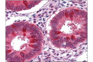 Immunohistochemistry (Paraffin-embedded Sections) (IHC (p)) image for anti-RuvB-Like 2 (E. Coli) (RUVBL2) (Ser129) antibody (ABIN615542)
