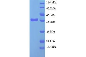 SDS-PAGE (SDS) image for PAP Associated Domain Containing 7 (PAPD7) (AA 723-1012), (partial) protein (His tag) (ABIN5713142) (PAP Associated Domain Containing 7 (PAPD7) (AA 723-1012), (partial) protein (His tag))