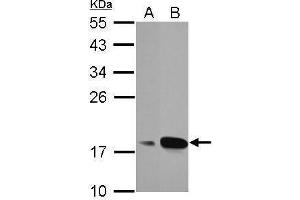 WB Image Sample (30 ug of whole cell lysate) A: A549 B: MCF-7 12% SDS PAGE antibody diluted at 1:1000 (AGR3 抗体  (Center))