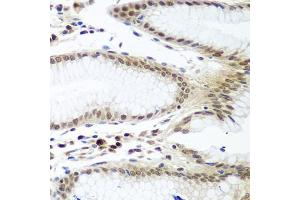 Immunohistochemistry of paraffin-embedded human stomach using PTTG1 antibody (ABIN5974823) at dilution of 1/100 (40x lens). (PTTG1 抗体)