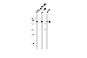 All lanes : Anti-CD63 Antibody (C-term) at 1:2000 dilution Lane 1: MDA-MB-453 whole cell lysate Lane 2:  whole cell lysate Lane 3:  whole cell lysate Lysates/proteins at 20 μg per lane. (CD63 抗体  (C-Term))