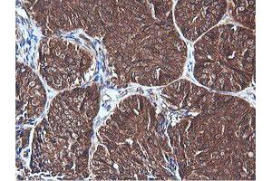 Image no. 4 for anti-Phosphatidylinositol-4-Phosphate 3-Kinase, Catalytic Subunit Type 2 beta (PIK3C2B) antibody (ABIN1500199)