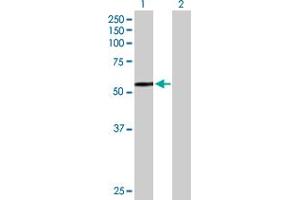 Western Blot analysis of HEXA expression in transfected 293T cell line by HEXA MaxPab polyclonal antibody. (Hexosaminidase A 抗体  (AA 1-529))