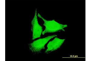 Immunofluorescence of monoclonal antibody to DEPDC1 on HeLa cell. (DEPDC1 抗体  (AA 93-186))