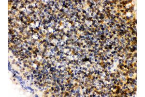 Anti- PLK1 Picoband antibody,IHC(P) IHC(P): Rat Lymphaden Tissue (PLK1 抗体  (AA 86-430))