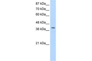 Western Blotting (WB) image for anti-La Ribonucleoprotein Domain Family, Member 7 (LARP7) antibody (ABIN2462269) (LARP7 抗体)