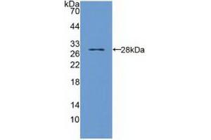 Western blot analysis of recombinant Human TIRAP. (TIRAP 抗体  (AA 1-221))