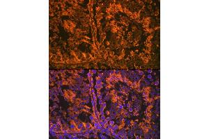 Immunofluorescence (IF) image for anti-Steroid-5-alpha-Reductase, alpha Polypeptide 2 (3-Oxo-5 alpha-Steroid delta 4-Dehydrogenase alpha 2) (SRD5A2) antibody (ABIN7270595)