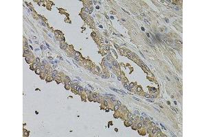 Immunohistochemistry of paraffin-embedded Human prostate using FMR1NB Polyclonal Antibody at dilution of 1:100 (40x lens). (FMR1NB 抗体)