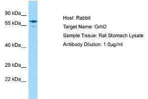 WB Suggested Anti-Grhl2 Antibody   Titration: 1. (GRHL2 抗体  (N-Term))