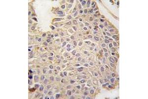 Image no. 3 for anti-Microtubule-Associated Protein 2 (MAP2) (C-Term) antibody (ABIN357399) (MAP2 抗体  (C-Term))