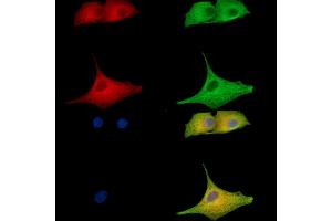 ABIN7096909 and ABIN7100975 staining  cells by IF/ICC. (Clavesin 1 抗体)