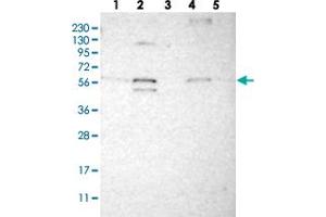 Western blot analysis of Lane 1: RT-4, Lane 2: U-251 MG, Lane 3: Human Plasma, Lane 4: Liver, Lane 5: Tonsil with C1orf27 polyclonal antibody  at 1:250-1:500 dilution. (ODR4 抗体)
