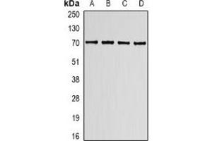 Western blot analysis of Lamin B Receptor expression in K562 (A), HT29 (B), mouse spleen (C), mouse lung (D) whole cell lysates. (Lamin B Receptor 抗体)