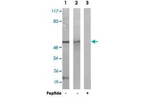 Western blot analysis of extracts from K-562 cells (Lane 1) and NIH/3T3 cells (Lane 2 and 3), using CAMK2A/CAMK2D polyclonal antibody . (CAMK2A 抗体)