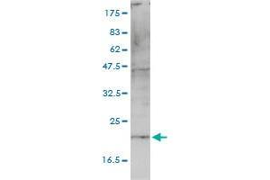 HSPC163 monoclonal antibody (M01), clone 4E10-1G4 Western Blot analysis of HSPC163 expression in A-431 . (CNIH4 抗体  (AA 1-139))