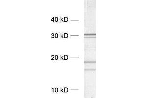 dilution: 1 : 5000, sample: crude synaptosomal fraction of rat brain (P2) (Clathrin 抗体  (AA 156-173))