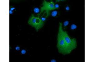 Anti-MTMR14 mouse monoclonal antibody (ABIN2453332) immunofluorescent staining of COS7 cells transiently transfected by pCMV6-ENTRY MTMR14 (RC207732). (MTMR14 抗体)