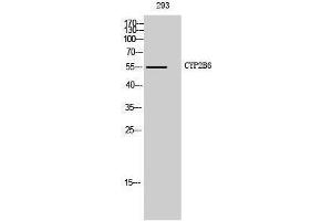 Western Blotting (WB) image for anti-Cytochrome P450, Family 2, Subfamily B, Polypeptide 6 (CYP2B6) (Internal Region) antibody (ABIN3184175) (CYP2B6 抗体  (Internal Region))