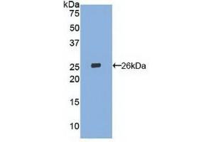 Detection of Recombinant LOX1, Human using Polyclonal Antibody to Lectin Like Oxidized Low Density Lipoprotein Receptor 1 (LOX1) (OLR1 抗体  (AA 81-273))