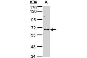 WB Image Sample(30 μg of whole cell lysate) A:A431, 7. (SHP1 抗体  (Center))