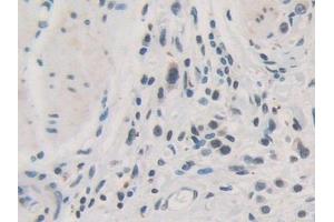 Immunohistochemistry (IHC) image for anti-Torsin Family 1, Member A (Torsin A) (TOR1A) (AA 33-321) antibody (ABIN7443317)