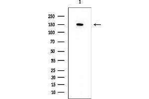Western blot analysis of lysates from Mouse brain, using ABCC1 Mouse Monoclonal Antibody at 1/1000 dilution.