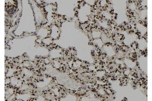 ABIN6273097 at 1/100 staining Rat lung tissue by IHC-P. (CEP164 抗体  (C-Term))