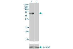 Western blot analysis of BMPR1B over-expressed 293 cell line, cotransfected with BMPR1B Validated Chimera RNAi (Lane 2) or non-transfected control (Lane 1).