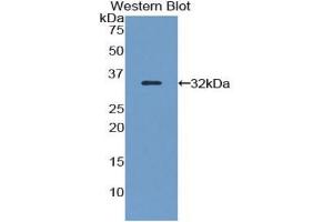 WB of Protein Standard: different control antibodies against Highly purified E. (FLNB ELISA 试剂盒)