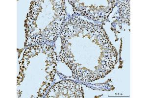 IHC analysis of SBNO1 using anti-SBNO1 antibody (ABIN7601710). (SBNO1 抗体  (AA 43-1303))