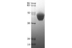 Validation with Western Blot (ESAM Protein (His tag))
