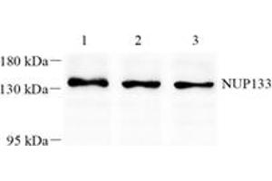 Western blot analysis of NUP133 (ABIN7074909) at dilution of 1: 1000,Lane 1: K562 cell lysate,Lane 2: 293 cell lysate,Lane 3: A375 cell lysate (NUP133 抗体)