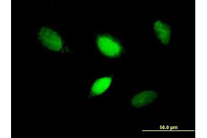 Immunofluorescence of purified MaxPab antibody to T on HeLa cell. (T Brachyury Protein (AA 1-377) 抗体)