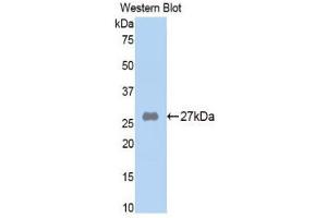Western Blotting (WB) image for anti-alpha-2-Macroglobulin (A2M) (AA 818-1048) antibody (ABIN1857845) (alpha 2 Macroglobulin 抗体  (AA 818-1048))