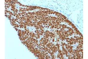 Immunohistochemistry (IHC) image for anti-Caudal Type Homeobox 2 (CDX2) (AA 150-249) antibody (ABIN6939057)
