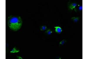 Immunofluorescence staining of MCF-7 cells with ABIN7163836 at 1:100, counter-stained with DAPI. (PKD2 抗体  (AA 680-968))