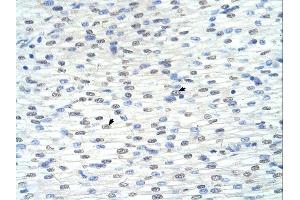 RNF8 antibody was used for immunohistochemistry at a concentration of 4-8 ug/ml. (RNF8 抗体  (C-Term))